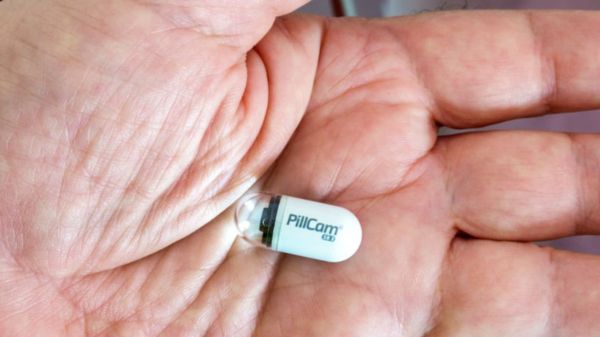 В Британии испытывают капсулы с камерой для ранней диагностики рака кишечника