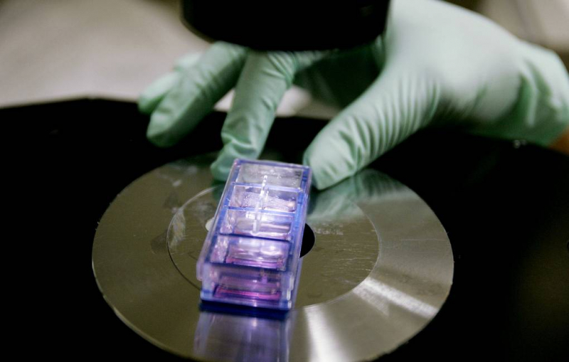 Короткую жизнь мужчин связали с “токсическим" действием Y-хромосомы