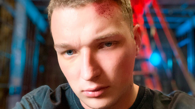 Следствие не планирует арестовывать блогера, который выехал на встречную полосу и стал участником ДТП