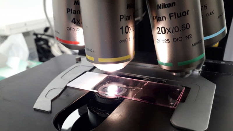 Ученые вырастили в биореакторе крошечный фрагмент мозга