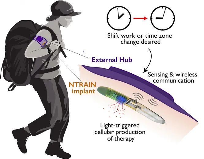 Ученые разрабатывают имплант, который будет контролировать сон человека