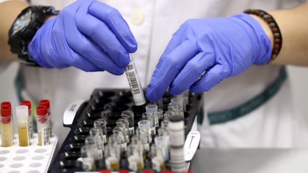 В России признали дефицит наиболее показательных тестов на антитела