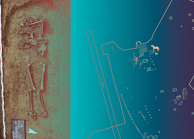 Палеопатологи обнаружили самый тяжелый случай деформации Маделунга на древних останках