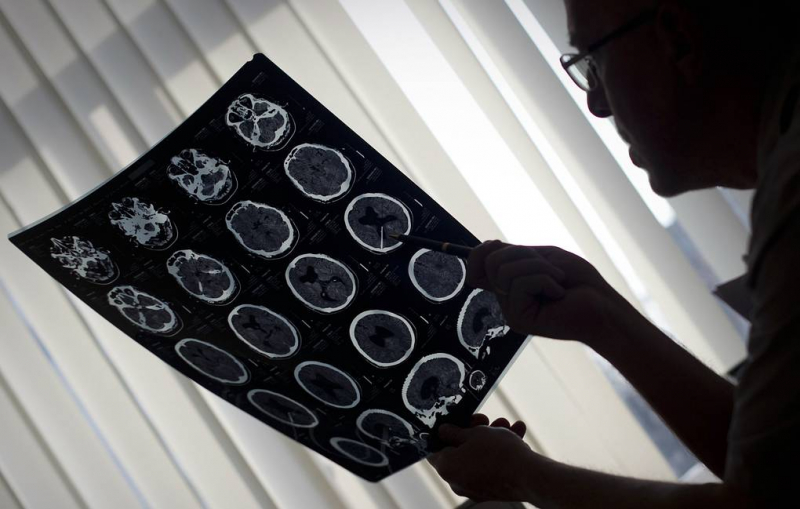 Ученые открыли область мозга, отвечающую за материнские защитные инстинкты