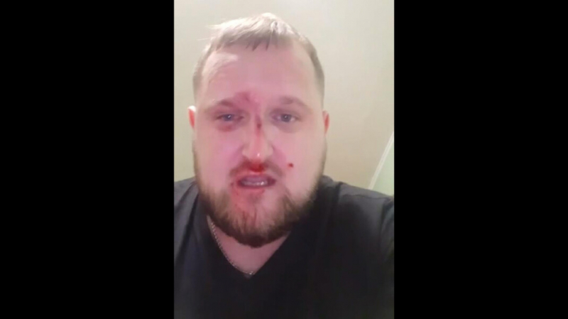 В Благовещенске избили журналиста &laquo;Радио Свобода&raquo;. Он подозревает в нападении местного единоросса