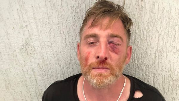 Протесты в Грузии: драка в парламенте из-за избиения журналистов, оппозиция собирает митинг