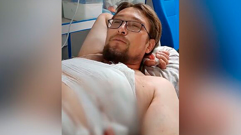 Полиция отчиталась о задержании напавших на активиста после его обращения на прямую линию Путина