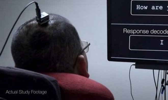 В США впервые разработали нейропротез, способный превращать мысли в текст