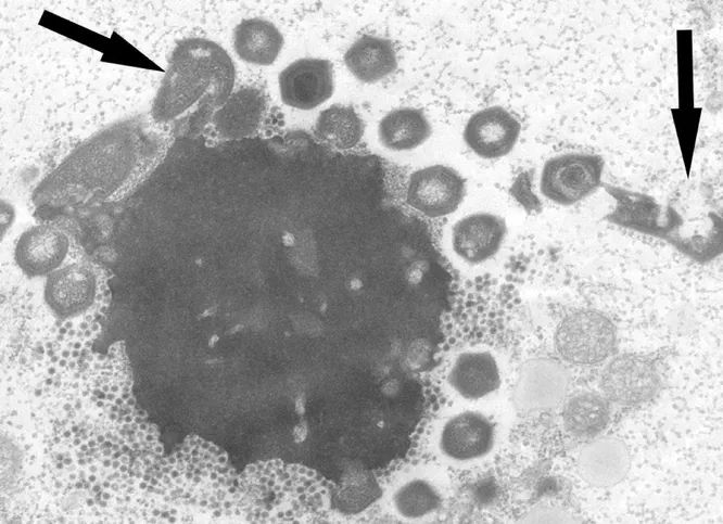 Паразиты паразитов
