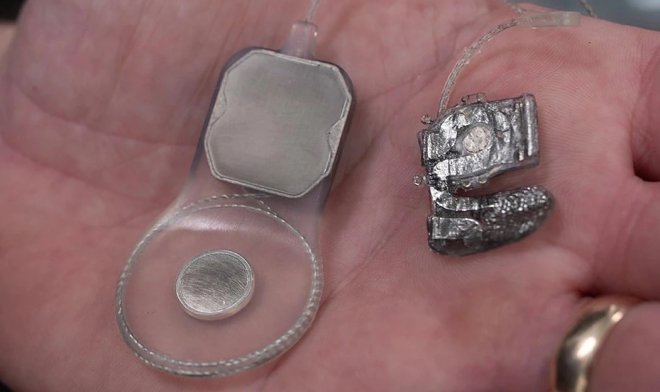 Бионический глаз Phoenix99 готов к испытаниям на людях