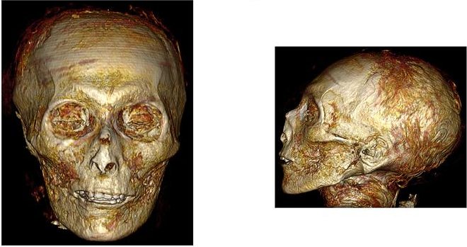 Компьютерная томография помогла «снять бинты» с мумии фараона Аменхотепа I