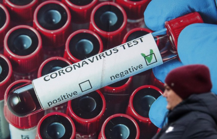 Мурашко отметил способность всех имеющихся тестов на COVID диагностировать "омикрон"