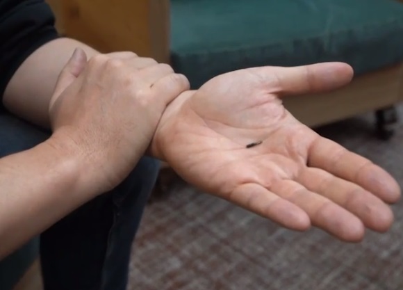 Под вашей кожей: Микрочип, имплантированный в руку, может отслеживать состояние вакцины Covid с помощью сканирования мобильного телефона