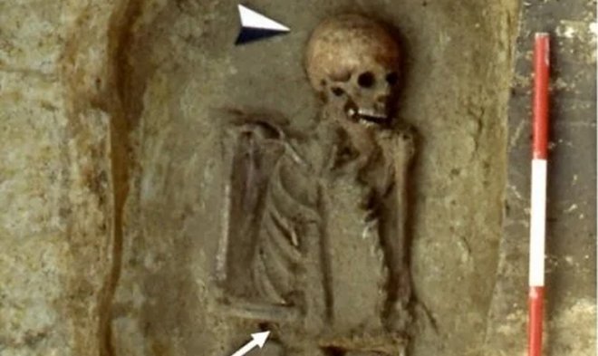 Средневековый итальянец заменил свою руку хитроумным ножом