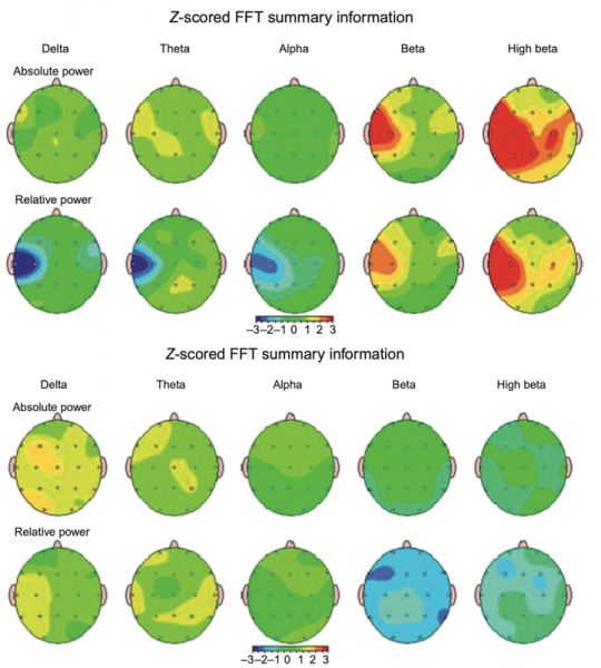 Как устроена боль и может ли она быть беспричинной