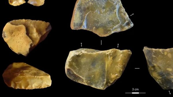 Новости науки: как разглядеть Альцгеймера на снимке МРТ, и кому нужен обет безбрачия?