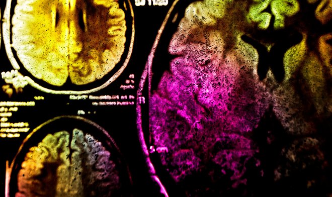 Фотоиммунотерапия поможет бороться с раком при помощи света