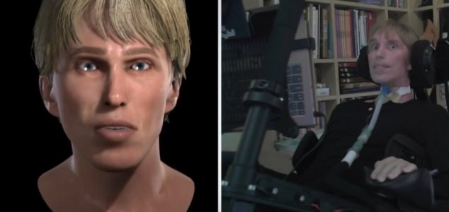 Первый в мире "человек-киборг" умер в возрасте 64 лет