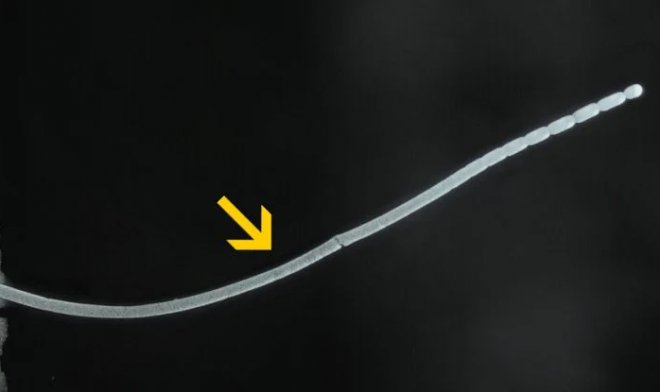 Ученые нашли самую крупную бактерию в мире &mdash; ее можно взять в руку 