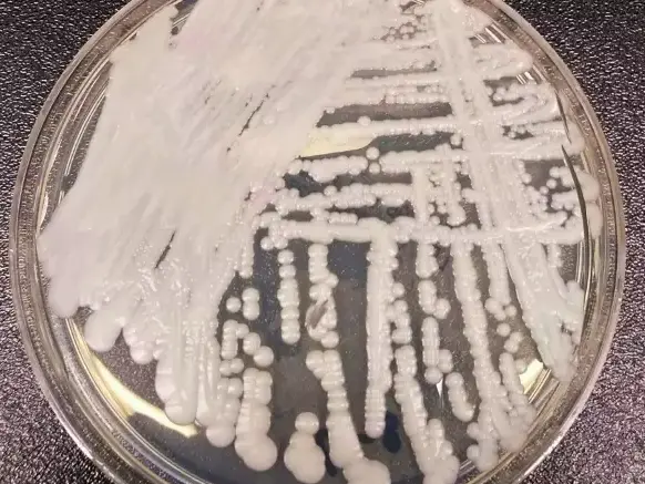 У смертоносного грибка обнаружили половое размножение.  Так он становится опаснее