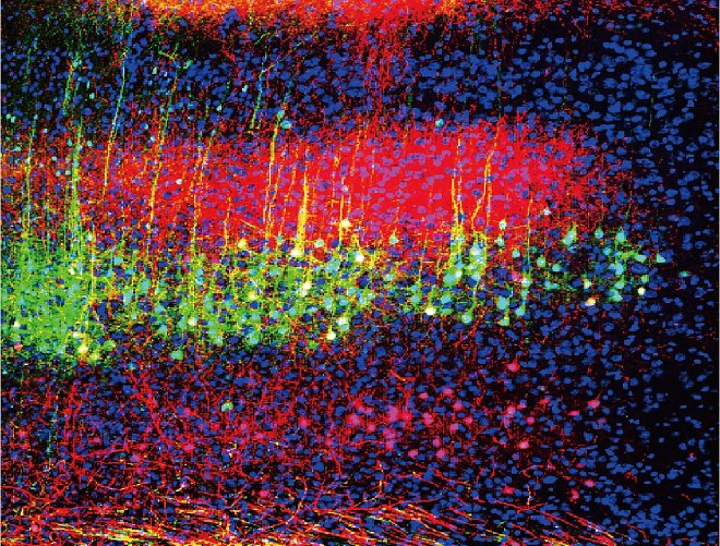 Ученые доказали возможность применять звук для анестезии 