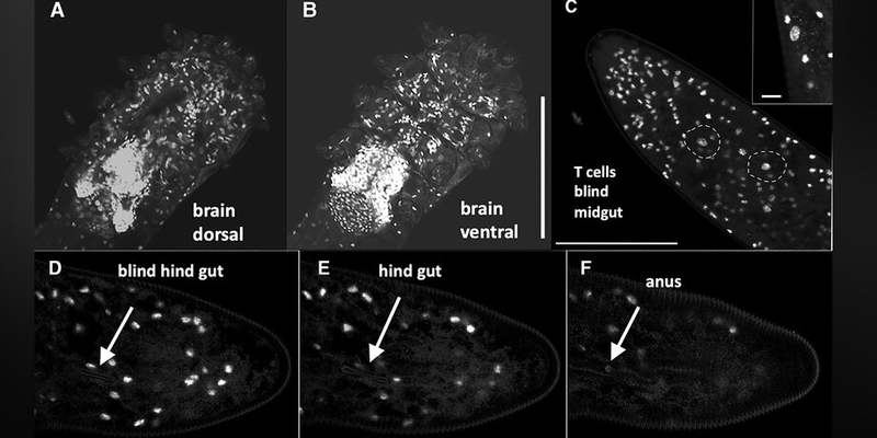 Ученые обнаружили микроскопического клеща, обитающего на лице человека