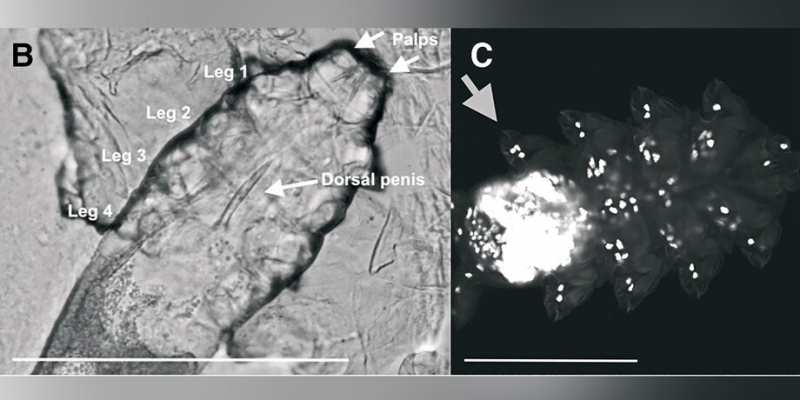 Ученые обнаружили микроскопического клеща, обитающего на лице человека