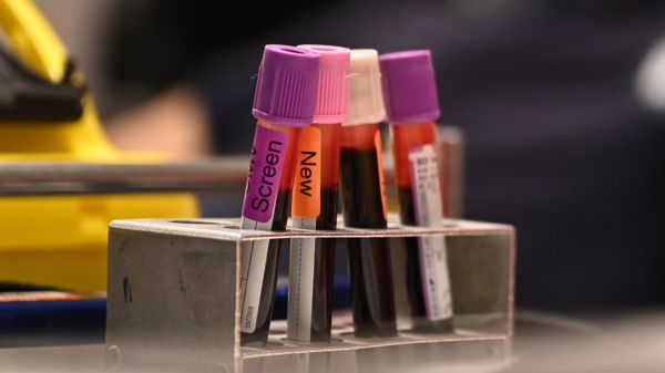 "Не так мертво, как казалось": ученые смогли оживить органы свиньи через час после смерти. Что сулит это открытие?