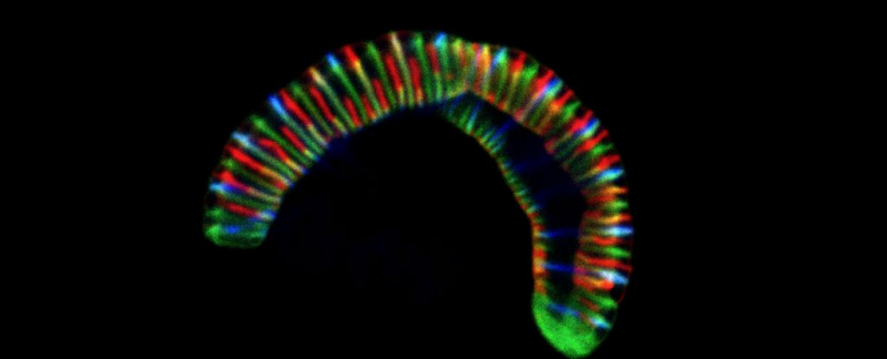 Этот похожий на гусеницу организм может ползать у вас во рту прямо сейчас