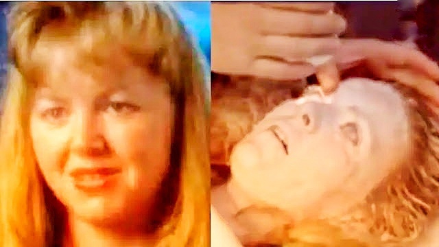 Несколько десятилетий назад женщина выжила, будучи "замороженной до твердого состояния"