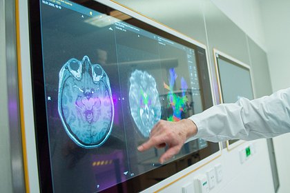 Исследовано отличие мозга неандертальца от современных людей