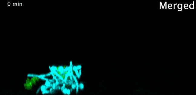 Биологи обнаружили, что вызывающие кариес микробы «катаются» по зубам на грибках