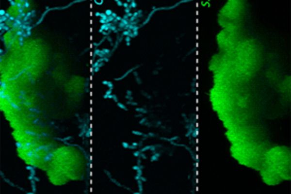 Биологи обнаружили, что вызывающие кариес микробы «катаются» по зубам на грибках