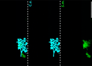Биологи обнаружили, что вызывающие кариес микробы «катаются» по зубам на грибках