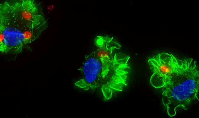 Токсоплазма использует для заражения людей тактику &laquo;обратного троянского коня&raquo; 