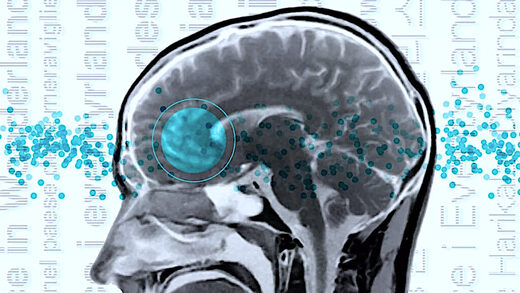 В мозге обнаружена "универсальная языковая сеть"