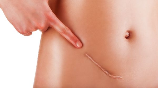 Биоинженеры создали материал, который вводится внутривенно и заживляет ткани изнутри