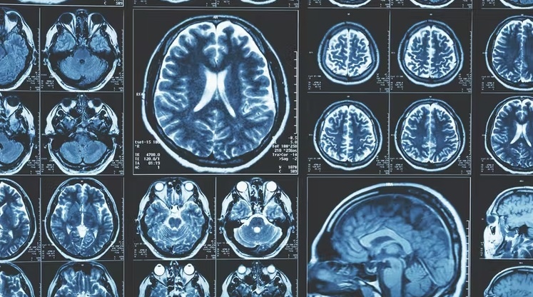 Что такого в человеческом мозге, что делает нас умнее других животных?