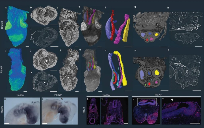 Нанопластик вызвал пороки сердца, зрения и нервной системы у эмбрионов