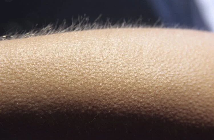 Почему у людей не растет шерсть &mdash; самые популярные гипотезы