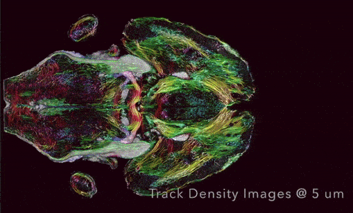 Ученые научились делать фантастически четкую МРТ мозга