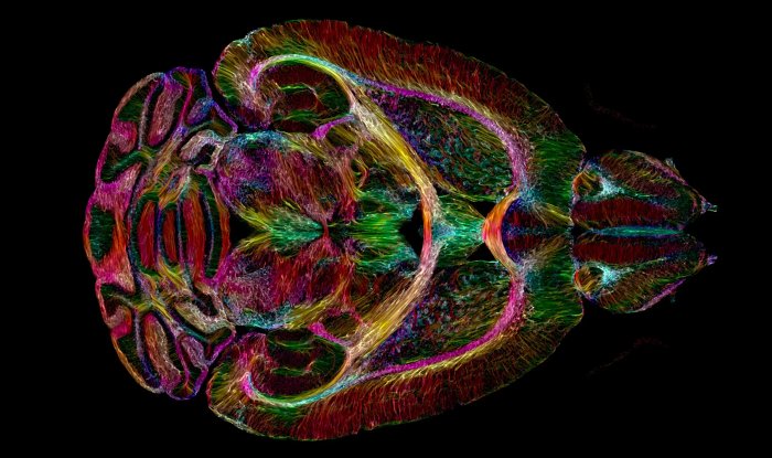 Ученые научились делать фантастически четкую МРТ мозга