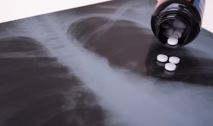 В США начались клинические испытания &laquo;таблеток от радиации&raquo;