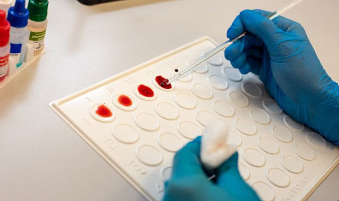 В России смогут определять сепсис всего за одни сутки