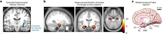 Нейробиологи объяснили, как работает наша пространственная память
