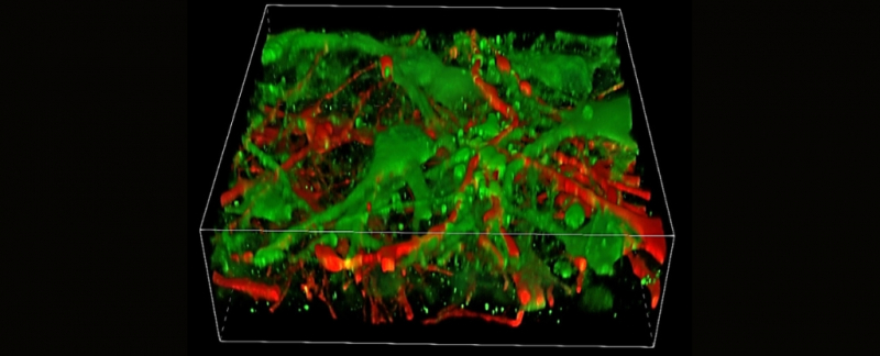 Первая в мире нервная ткань, напечатанная на 3D-принтере, растет и функционирует как человеческий мозг