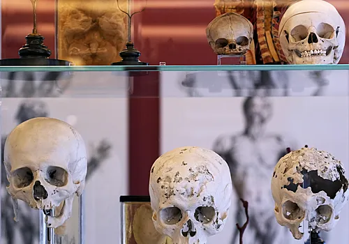 Ученые зафиксировали рост объема мозга человека в&nbsp;течение XX&nbsp;века