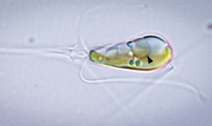 Редчайший случай в эволюции &ndash; две формы жизни слились в единое целое