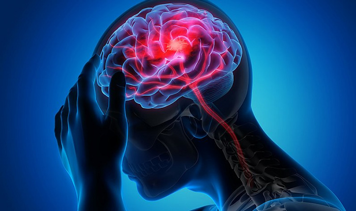 Стремительные изменения климата резко увеличили количество инсультов