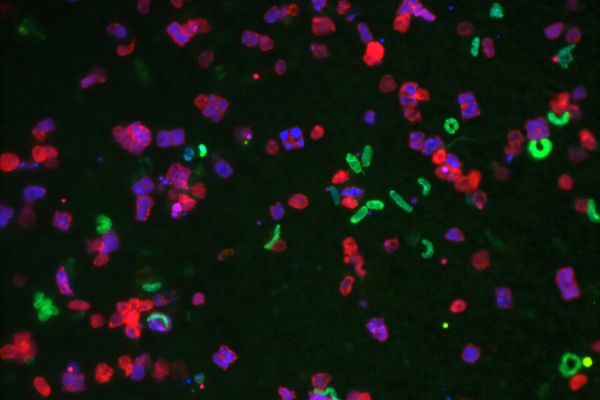 Ученые разгадали тайну цветений токсичных водорослей вблизи городов